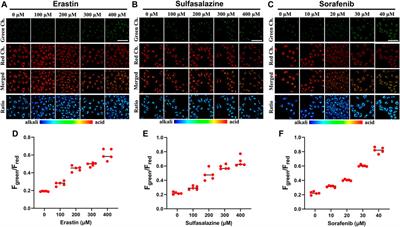 A cascading-response fluorescent probe for real-time pH monitoring during cysteine-depletion process in pancreatic cancer cells